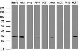 Image no. 5 for anti-Signal Recognition Particle Receptor, B Subunit (SRPRB) antibody (ABIN1501128) (SRPRB Antikörper)