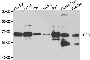Western blot analysis of extracts of various cell lines, using C8B antibody. (C8B Antikörper)