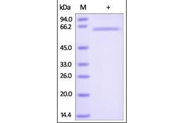 TNFRSF6B Protein (AA 30-300) (Fc Tag)