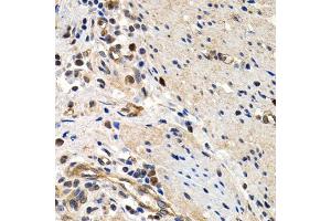 Immunohistochemistry of paraffin-embedded human colon using MCM2 antibody (ABIN5970415) at dilution of 1/200 (40x lens). (MCM2 Antikörper)