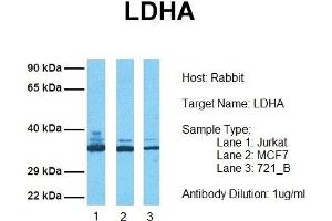 Host: Rabbit Target Name: LDHA Sample Tissue: Human Jurkat, MCF7, 721_B Antibody Dilution: 1. (Lactate Dehydrogenase A Antikörper  (Middle Region))