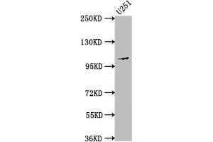 Western Blot Positive WB detected in: U251 whole cell lysate All lanes: MME antibody at 1:1500 Secondary Goat polyclonal to rabbit IgG at 1/50000 dilution Predicted band size: 86 kDa Observed band size: 100 kDa (Rekombinanter MME Antikörper)