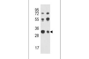 Western blot analysis of RPA43 Antibody in Jurkat,K562 cell line lysates (35ug/lane) (TWIST Neighbor Antikörper  (C-Term))