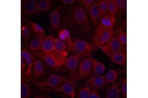 Immunofluorescence staining of methanol-fixed MCF7 cells using VEGFR2 (phospho-Tyr1175) antibody (E011084, Red) (VEGFR2/CD309 Antikörper  (pTyr1175))