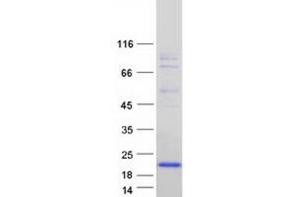 FXYD6 Protein (Transcript Variant 4) (Myc-DYKDDDDK Tag)