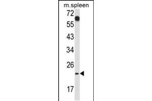 Western blot analysis of CD7 Antibody in mouse spleen tissue lysates (35ug/lane) (CD7 Antikörper  (AA 65-91))