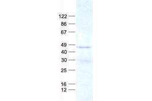 Validation with Western Blot (CEACAM6 Protein (His tag))