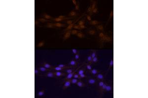 Immunofluorescence analysis of PC-12 cells using Chk1 Rabbit pAb (ABIN6134818, ABIN6138518, ABIN6138519 and ABIN6223572) at dilution of 1:25 (40x lens). (CHEK1 Antikörper)