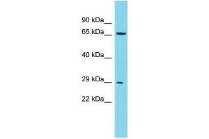 Host: Rabbit Target Name: CCDC124 Sample Type: 293T Whole Cell lysates Antibody Dilution: 1. (CCDC124 Antikörper  (N-Term))