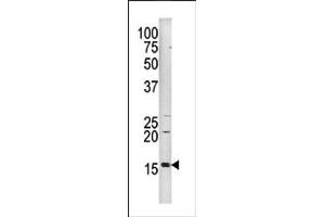 Image no. 1 for anti-Histone 3 (H3) (pSer10) antibody (ABIN358063) (Histone 3 Antikörper  (pSer10))