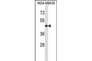 PK3 Antibody (ABIN1539804 and ABIN2843791) western blot analysis in MDA-M cell line lysates (35 μg/lane). (ERK1 Antikörper)