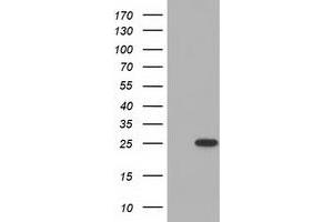 HEK293T cells were transfected with the pCMV6-ENTRY control (Left lane) or pCMV6-ENTRY MOBKL2B (Right lane) cDNA for 48 hrs and lysed. (MOBKL2B Antikörper)