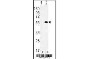 Western blot analysis of PRMT2 using rabbit polyclonal PRMT2 Antibody (L359) using 293 cell lysates (2 ug/lane) either nontransfected (Lane 1) or transiently transfected (Lane 2) with the PRMT2 gene. (PRMT2 Antikörper  (C-Term))