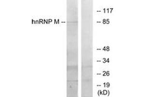 Western blot analysis of extracts from HT-29 cells, using hnRNP M Antibody. (HNRNPM Antikörper  (AA 11-60))