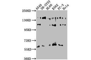 Western Blot Positive WB detected in: A549 whole cell lysate, SH-SY5Y whole cell lysate, HL60 whole cell lysate, K562 whole cell lysate, PC-3 whole cell lysate, Hela whole cell lysate All lanes: SOS2 antibody at 1:1000 Secondary Goat polyclonal to rabbit IgG at 1/50000 dilution Predicted band size: 153, 150 kDa Observed band size: 153 kDa (SOS2 Antikörper  (AA 187-404))