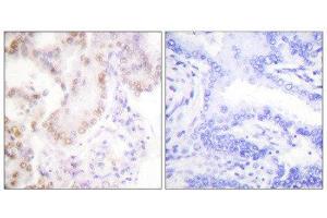 Immunohistochemistry (IHC) image for anti-Cyclin G1 (CCNG1) (Internal Region) antibody (ABIN1848500) (Cyclin G1 Antikörper  (Internal Region))