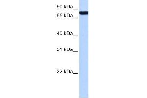 ZNF33A antibody used at 2 ug/ml to detect target protein. (ZNF33A Antikörper  (Middle Region))