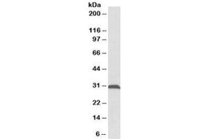 Western blot testing of rat skeletal muscle lysate with ATPG antibody at 0. (ATPG Antikörper)