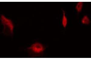 ABIN6267563 staining HeLa by IF/ICC. (RPS6 Antikörper  (pSer235))