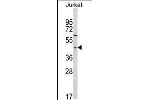 Western blot analysis of PTAR1 Antibody in Jurkat cell line lysates (35ug/lane) (PTAR1 Antikörper  (AA 60-89))