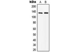 Western blot analysis of ABL1 expression in MCF7 (A), HepG2 (B) whole cell lysates. (ABL1 Antikörper  (N-Term))