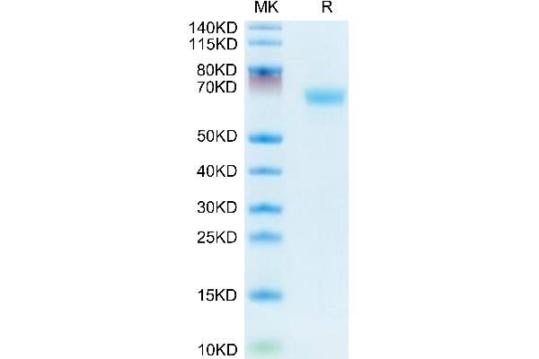 LAMP5 Protein (AA 30-235) (Fc Tag)