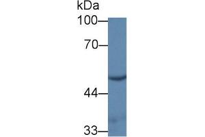 Western blot analysis of Rat Kidney lysate, using Mouse UMPS Antibody (1 µg/ml) and HRP-conjugated Goat Anti-Rabbit antibody ( (UMPS Antikörper  (AA 311-481))