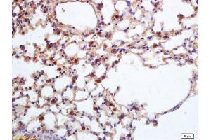 Formalin-fixed and paraffin embedded mouse lung labeled with Rabbit Anti CXC-R2 Polyclonal Antibody, Unconjugated (ABIN1386761) at 1:200 followed by conjugation to the secondary antibody and DAB staining (CXCR2 Antikörper)