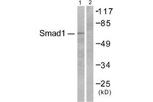 Western Blotting (WB) image for anti-SMAD, Mothers Against DPP Homolog 1 (SMAD1) (Ser465) antibody (ABIN1847896) (SMAD1 Antikörper  (Ser465))