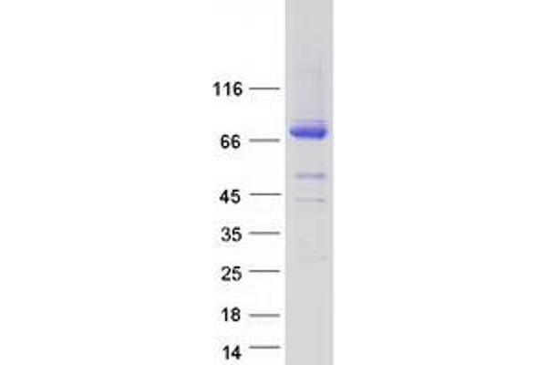 CRTAC1 Protein (Myc-DYKDDDDK Tag)