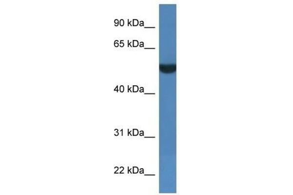 FSD1L Antikörper  (C-Term)