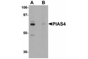 Image no. 1 for anti-Protein Inhibitor of Activated STAT, 4 (PIAS4) (N-Term) antibody (ABIN478293) (PIAS4 Antikörper  (N-Term))