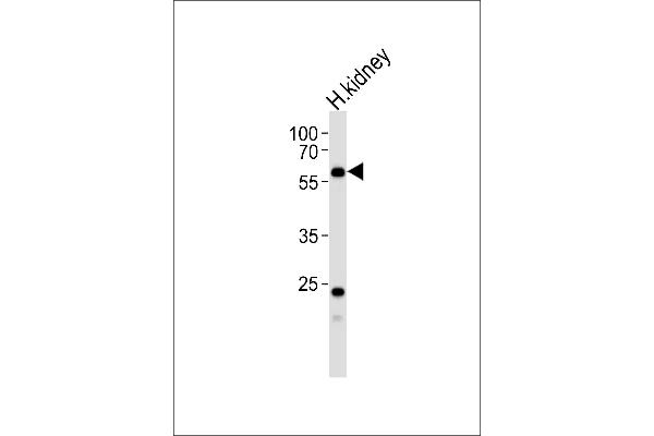 PFKFB3 Antikörper  (C-Term)