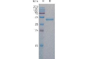 Human Protein, His Tag on SDS-PAGE under reducing condition. (PAI1 Protein (AA 24-402) (His tag))