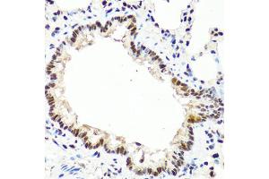 Immunohistochemistry of paraffin-embedded rat lung using TET2 antibody. (TET2 Antikörper)