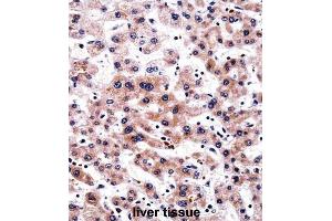 Immunohistochemistry (IHC) image for anti-RCAN Family Member 3 (RCAN3) antibody (ABIN2997962) (RCAN3 Antikörper)