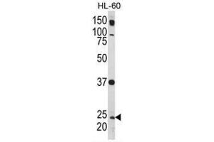 Western blot analysis of Rab5 Antibody (C-term) in HL-60 cell line lysates (35ug/lane). (RAB5 Antikörper  (C-Term))