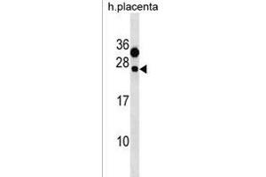 CLEC6A Antibody (C-term) (ABIN1536706 and ABIN2850181) western blot analysis in human placenta tissue lysates (35 μg/lane). (C-Type Lectin Domain Family 6, Member A (CLEC6A) (AA 137-163), (C-Term) Antikörper)