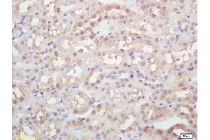 Formalin-fixed and paraffin embedded rat kidney labeled with Rabbit Anti KIFC1 Polyclonal Antibody, Unconjugated (ABIN873143) at 1:200 followed by conjugation to the secondary antibody and DAB staining (KIFC1 Antikörper)