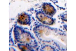 Used in DAB staining on fromalin fixed paraffin-embedded Intestine tissue (AGGF1 Antikörper  (AA 406-501))