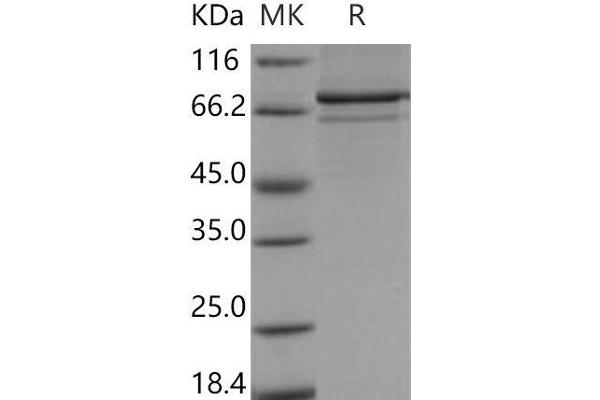 MAPKAP Kinase 5 Protein (GST tag,His tag)