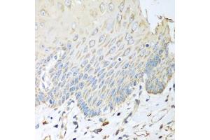 Immunohistochemistry of paraffin-embedded human esophagus using SGCB antibody. (SGCB Antikörper)