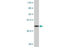 Western Blot detection against Immunogen (37. (KRT8 Antikörper  (AA 91-195))