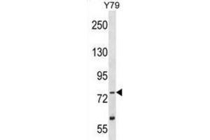 Western Blotting (WB) image for anti-Tousled-Like Kinase 2 (TLK2) antibody (ABIN2995273) (TLK2 Antikörper)