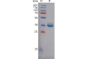 Human EREG Protein, hFc Tag on SDS-PAGE under reducing condition. (Epiregulin Protein (EREG) (AA 63-108) (Fc Tag))