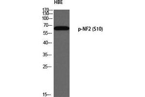 Western Blot (WB) analysis of HBE using p-NF2 (S10) antibody. (Merlin Antikörper  (pSer10))