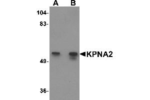 Western Blotting (WB) image for anti-Karyopherin alpha 2 (RAG Cohort 1, Importin alpha 1) (KPNA2) (N-Term) antibody (ABIN1031430) (KPNA2 Antikörper  (N-Term))