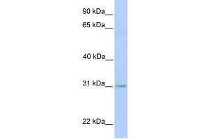 Western Blotting (WB) image for anti-Membrane-Associated Ring Finger (C3HC4) 2, E3 Ubiquitin Protein Ligase (MARCH2) antibody (ABIN2458695) (MARCH2 Antikörper)