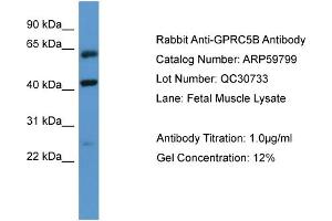 WB Suggested Anti-GPRC5B  Antibody Titration: 0. (GPRC5B Antikörper  (N-Term))