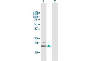 Western Blot analysis of IFNB1 expression in transfected 293T cell line by IFNB1 MaxPab polyclonal antibody. (IFNB1 Antikörper  (AA 1-187))